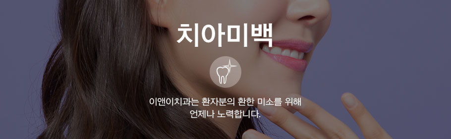 치아미백 상단