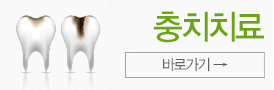 충치치료바로가기